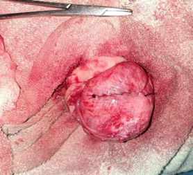 Cystotomy wound closed with Cushings suture pattern