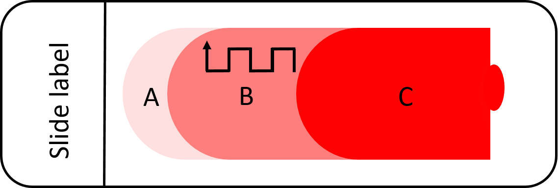 figure-5-the-battle-meander-method-for-differential-white-cell