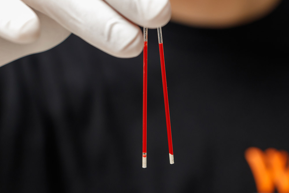 Capillary Tube Pcv edu.svet.gob.gt