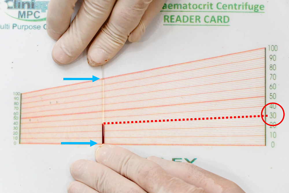 Haematocrit pcv deals