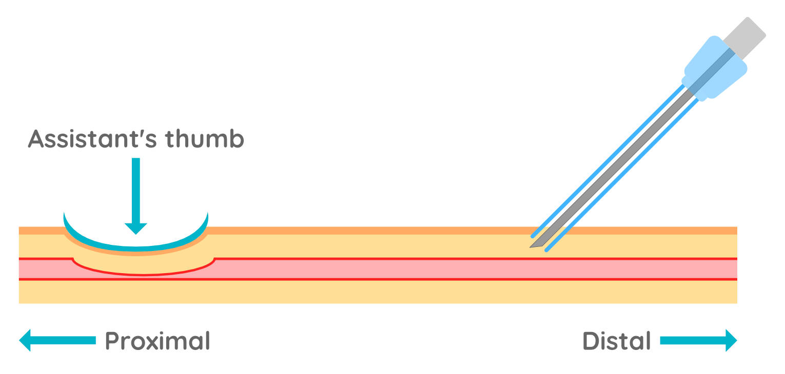 how long can an iv catheter stay in a dog