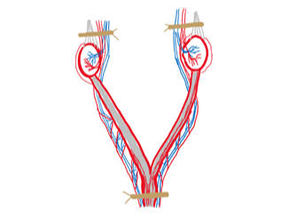 Ovariohysterectomy versus Ovariectomy - which technique should I use?